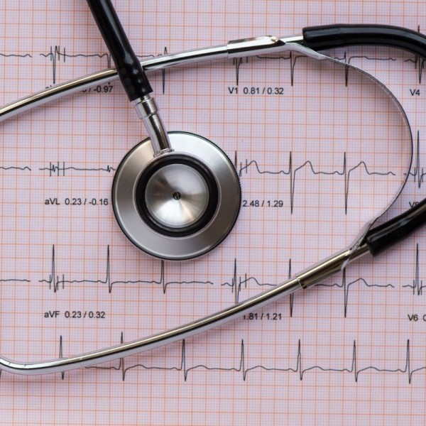 EKG (Kardiyolog tarafından) 1